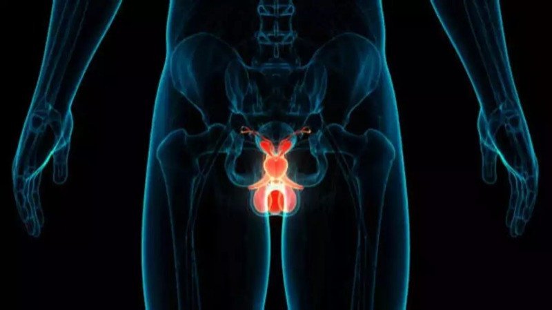Prostate prostate health
